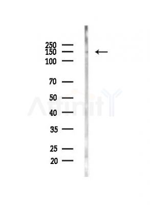 PLCG1 Antibody - Western blot analysis of lysates from PC12 cells(LPS,4h treatment), using PLCG1 Antibody at 1/1000 dilution.