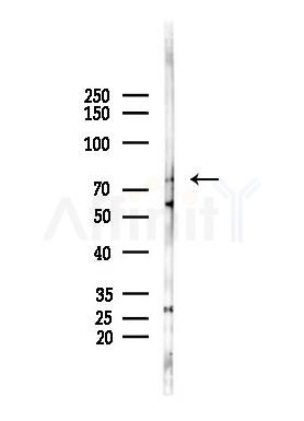 PKR Antibody - Western blot analysis of lysates from Mouse lung, using PKR Antibody at 1/1000 dilution.