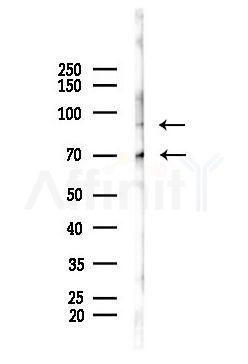 p70 S6 Kinase Antibody - Western blot analysis of lysates from Mouse lung, using p70 S6 Kinase Antibody at 1/1000 dilution.