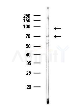 p70 S6 Kinase Antibody - Western blot analysis of lysates from A549 cells, using p70 S6 Kinase Antibody at 1/1000 dilution.