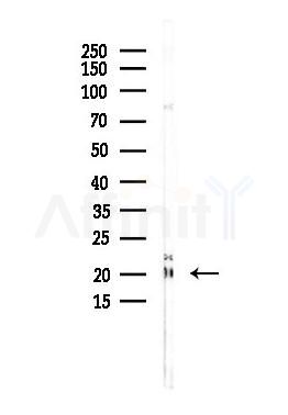 Cofilin Antibody - Western blot analysis of lysates from Rat muscle, using Cofilin Antibody at 1/1000 dilution.
