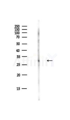 CDK1/CDC2 Antibody - Western blot analysis of lysates from HepG2 cells(LPS,4h treatment), using CDK1/CDC2 Antibody at 1/1000 dilution.