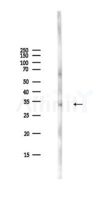 CDK1/CDC2 Antibody - Western blot analysis of lysates from PC12 cells(LPS,4h treatment), using CDK1/CDC2 Antibody at 1/1000 dilution.