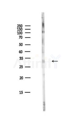 CDK2 Antibody - Western blot analysis of lysates from HepG2 cells(LPS,4h treatment), using CDK2 Antibody at 1/1000 dilution.