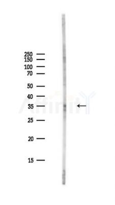 CDK2 Antibody - Western blot analysis of lysates from PC12 cells(LPS,4h treatment), using CDK2 Antibody at 1/1000 dilution.