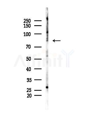 PI3K p85 alpha Antibody - Western blot analysis of lysates from Mouse lung, using PI3K p85 alpha Antibody at 1/1000 dilution.