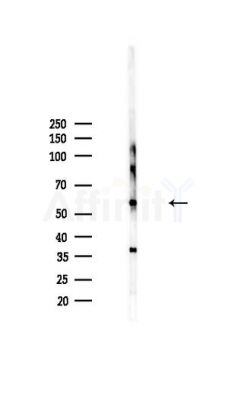 pan-AKT1/2/3 Antibody - Western blot analysis of lysates from HepG2 cells(heat-shock,45min treatment), using pan-AKT1/2/3 Antibody at 1/1000 dilution.