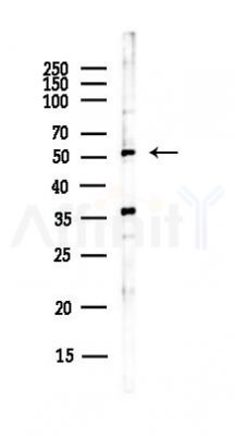 pan-AKT1/2/3 Antibody - Western blot analysis of lysates from Hela cells(UV, 30min treatment), using pan-AKT1/2/3 Antibody at 1/1000 dilution.