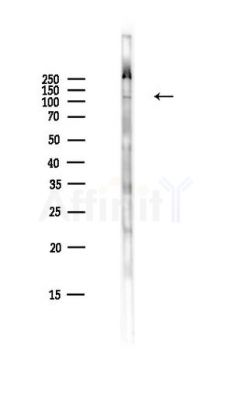 VE-Cadherin Antibody - Western blot analysis of lysates from HepG2 cells(LPS,4h treatment), using VE-Cadherin Antibody at 1/1000 dilution.