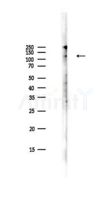 VE-Cadherin Antibody - Western blot analysis of lysates from PC12 cells(LPS,4h treatment), using VE-Cadherin Antibody at 1/1000 dilution.