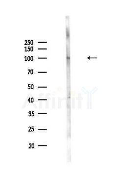beta Catenin Antibody - Western blot analysis of lysates from Mouse lung, using beta Catenin Antibody at 1/1000 dilution.
