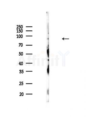 beta Catenin Antibody - Western blot analysis of lysates from HUVEC cells, using beta Catenin Antibody at 1/1000 dilution.