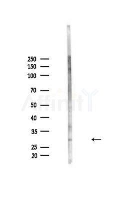 DDIT3/CHOP Antibody - Western blot analysis of lysates from HepG2 cells(heat-shock,45min treatment), using DDIT3/CHOP Antibody at 1/1000 dilution.