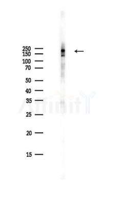 VEGFR2 Antibody - Western blot analysis of lysates from PC12 cells(LPS,4h treatment), using VEGFR2 Antibody at 1/1000 dilution.