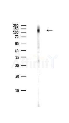 SREBP1 Antibody - Western blot analysis of lysates from HepG2 cells(LPS,4h treatment), using SREBP1 Antibody at 1/1000 dilution.
