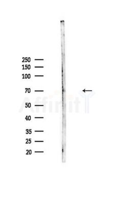 PPAR gamma Antibody - Western blot analysis of lysates from HepG2 cells(heat-shock,45min treatment), using PPAR gamma Antibody at 1/1000 dilution.