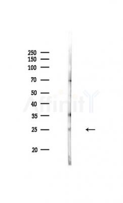 VHL Antibody - Western blot analysis of lysates from PC12 cells, using VHL Antibody at 1/1000 dilution.