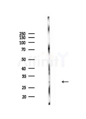 VHL Antibody - Western blot analysis of lysates from HUVEC cells, using VHL Antibody at 1/1000 dilution.