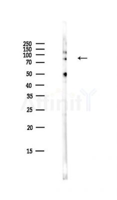 STAT3 Antibody - Western blot analysis of lysates from HepG2 cells(LPS,4h treatment), using STAT3 Antibody at 1/1000 dilution.