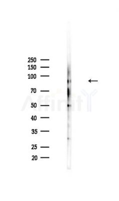 STAT1 Antibody - Western blot analysis of lysates from HepG2 cells(heat-shock,45min treatment), using STAT1 Antibody at 1/1000 dilution.