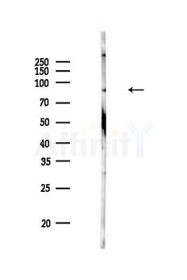 STAT1 Antibody - Western blot analysis of lysates from HUVEC cells, using STAT1 Antibody at 1/1000 dilution.