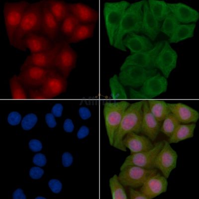 STAT5A Antibody - AF6303 staining Hela cells(45min of heat-shock) by IF/ICC.