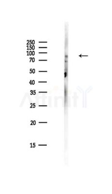 GluR2 Antibody - Western blot analysis of lysates from HepG2 cells(LPS,4h treatment), using GluR2 Antibody at 1/1000 dilution.