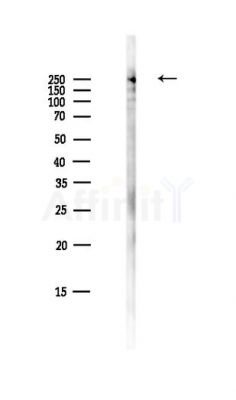 mTOR Antibody - Western blot analysis of lysates from HepG2 cells(LPS,4h treatment), using mTOR Antibody at 1/1000 dilution.