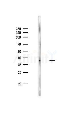 MEK4/MKK4 Antibody - Western blot analysis of lysates from PC12 cells, using MEK4/MKK4 Antibody at 1/1000 dilution.