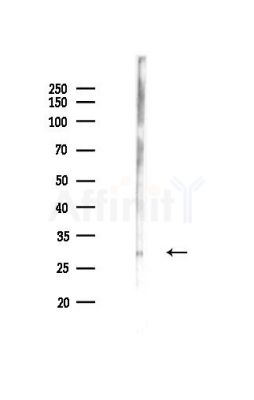 C/EBP alpha Antibody - Western blot analysis of lysates from Mouse lung, using C/EBP alpha Antibody at 1/1000 dilution.