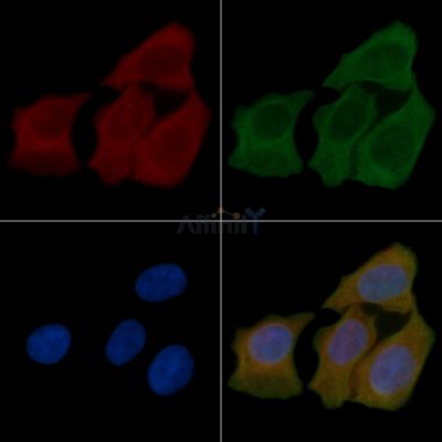 CCR5 Antibody - AF6339 staining Hela cells(45min of heat-shock) by IF/ICC.