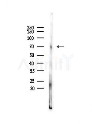 LIMK1 Antibody - Western blot analysis of lysates from HepG2 cells(heat-shock,45min treatment), using LIMK1 Antibody at 1/1000 dilution.