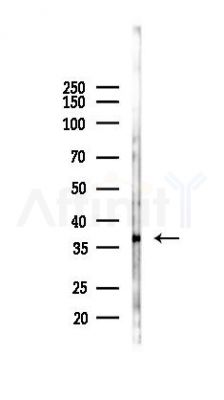 Smad3 Antibody - Western blot analysis of lysates from Mouse liver, using Smad3 Antibody at 1/1000 dilution.