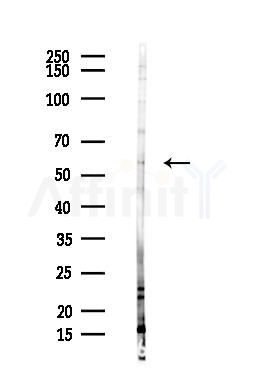 XIAP Antibody - Western blot analysis of lysates from Hela cells(heat-shock,45min treatment), using XIAP Antibody at 1/1000 dilution.