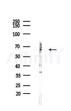FOXO4 Antibody - Western blot analysis of lysates from Hela cells(heat-shock,45min treatment), using FOXO4 Antibody at 1/1000 dilution.