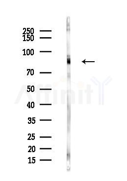 HSF1 Antibody - Western blot analysis of lysates from Hela cells(heat-shock,45min treatment), using HSF1 Antibody at 1/1000 dilution.