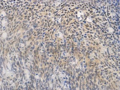 HSF1 Antibody - AF6372 at 1/100 staining human normal tonsil tissue by IHC-P.