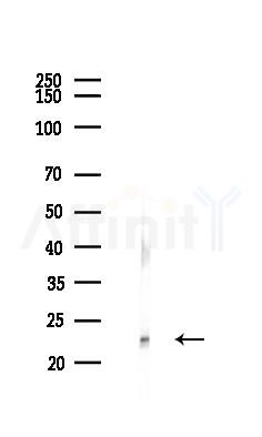 Caveolin 1 Antibody - Western blot analysis of lysates from Hela cells(heat-shock,45min treatment), using Caveolin 1 Antibody at 1/1000 dilution.