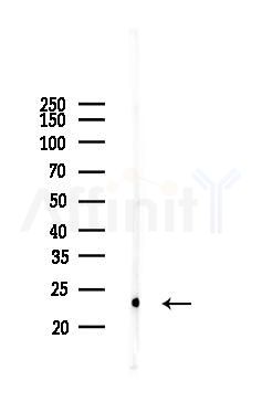 Caveolin 1 Antibody - Western blot analysis of lysates from PC12 cells, using Caveolin 1 Antibody at 1/1000 dilution.