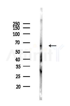 NF-kB p65 Antibody - Western blot analysis of lysates from COLO205 cells(LPS,4h treatment), using NF-kB p65 Antibody at 1/1000 dilution.