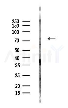 PKC theta Antibody - Western blot analysis of lysates from COLO205 cells(LPS,4h treatment), using PKC theta Antibody at 1/1000 dilution.
