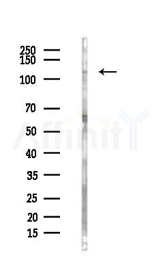 FAK Antibody - Western blot analysis of lysates from Hela cells(heat-shock,45min treatment), using FAK Antibody at 1/1000 dilution.