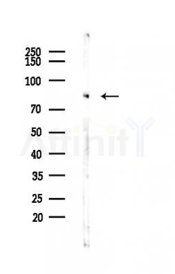 PKC zeta Antibody - Western blot analysis of lysates from Hela cells(heat-shock,45min treatment), using PKC zeta Antibody at 1/1000 dilution.