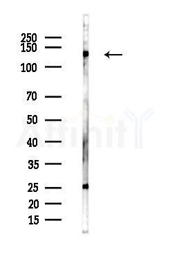 NMDAR1 Antibody - Western blot analysis of lysates from Hela cells(heat-shock,45min treatment), using NMDAR1 Antibody at 1/1000 dilution.