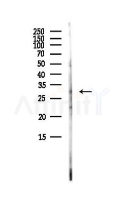 BCL-XL Antibody - Western blot analysis of lysates from HepG2 cells(LPS, 4h treatment), using BCL-XL Antibody at 1/1000 dilution.