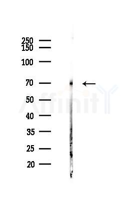 FOXO1A Antibody - Western blot analysis of lysates from Hela cells(heat-shock,45min treatment), using FOXO1A Antibody at 1/1000 dilution.