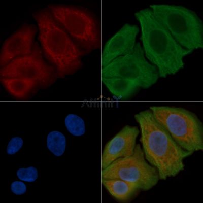 IL-10R alpha Antibody - AF6435 staining Hela cells(30min of UV treatment) by IF/ICC.