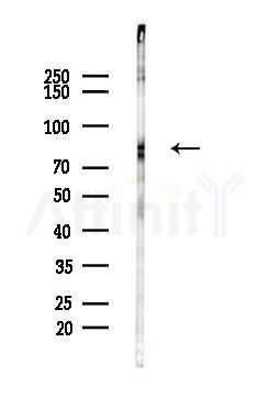 Cortactin Antibody - Western blot analysis of lysates from Hela cells(heat-shock,45min treatment), using Cortactin Antibody at 1/1000 dilution.