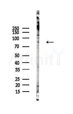 STAT4 Antibody - Western blot analysis of lysates from COLO205 cells(LPS,4h treatment), using STAT4 Antibody at 1/1000 dilution.