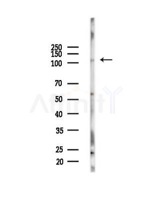 PKD1/PKC mu Antibody - Western blot analysis of lysates from PC12 cells(LPS,4h treatment), using PKD1/PKC mu Antibody at 1/1000 dilution.